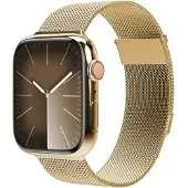 Vonmählen Milanese Loop 2