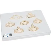 3B Scientific Wirbelmodell Set mit 7 BONElikeTM Halswirbeln - 3B Smart Anatomy