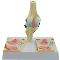 HeineScientific Kniegelenk-Modell Rheumatisch Knie-Modell Rheuma
