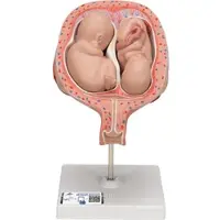 3B Scientific Zwillingsfeten Modell, 5. Monat, normale Position - 3B Smart Anatomy