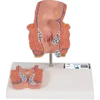 3B Scientific Hämorrhoidenmodell - 3B Smart Anatomy