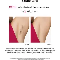 Ulike Air3 Plus Epilierer